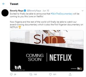 Beverly Naya's skin on Netflix